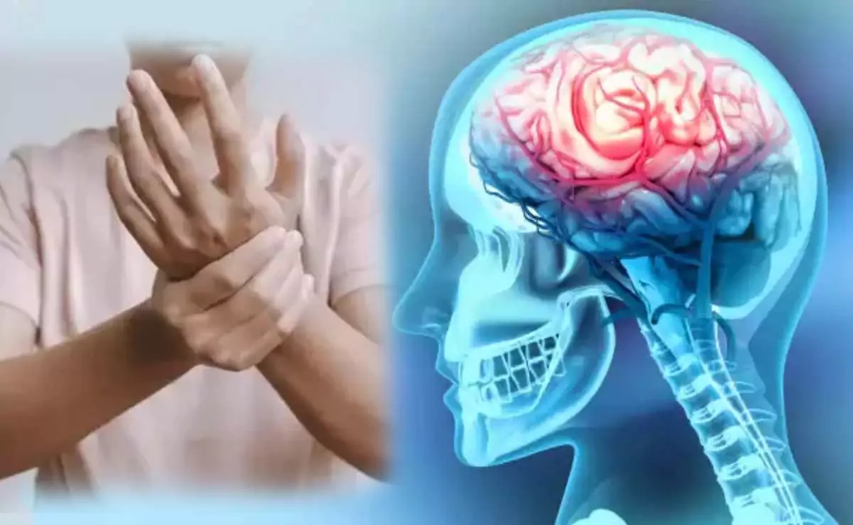 GBS Syndrome | దేశంలో విస్తరిస్తున్న మరో మహమ్మారి.. మహారాష్ట్రలో తొలి మరణం