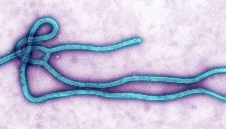 Ebola Virus